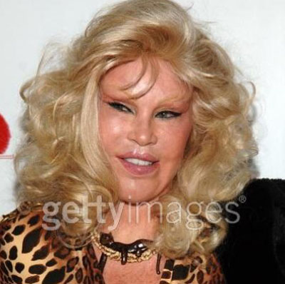 Jocelyn Wildenstein