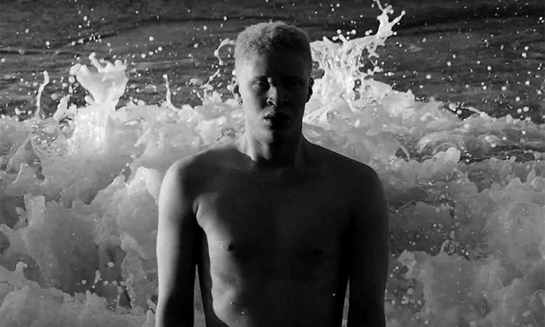 Omg He S Naked Albino Model Shaun Ross Serves Up Some Elephant Sized