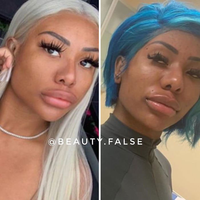 OMG, 'False.Beauty' Instagram exposes 