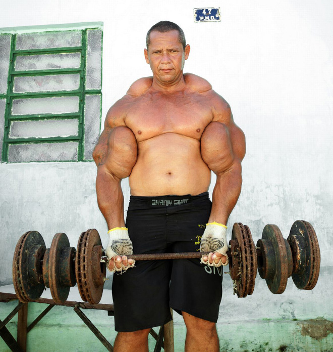 OMG, step inside the bizarre world of Synthol-overloaded bodybuilders 