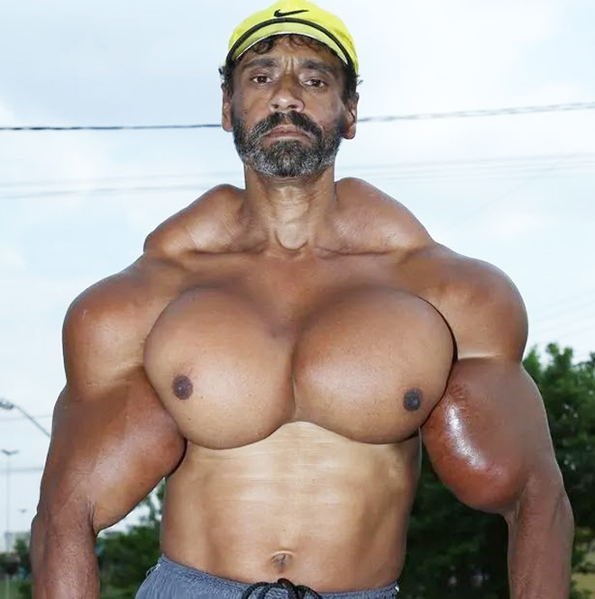 synthol oil
